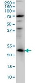 Monoclonal Anti-RAB3A antibody produced in mouse clone 4H7, purified immunoglobulin, buffered aqueous solution