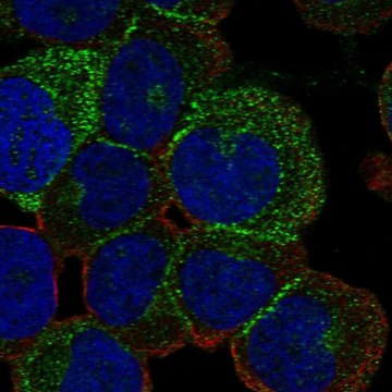 Anti-Esam Antibody Produced In Rabbit Prestige Antibodies&#174; Powered by Atlas Antibodies, affinity isolated antibody, buffered aqueous glycerol solution