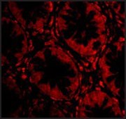 Anti-TEM2 antibody produced in rabbit affinity isolated antibody, buffered aqueous solution