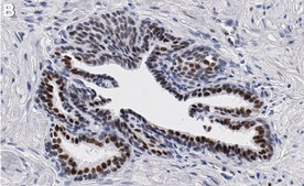 Anti-FOXP1 Antibody, clone 1J11-H1 ZooMAb® Rabbit Monoclonal recombinant, expressed in HEK 293 cells