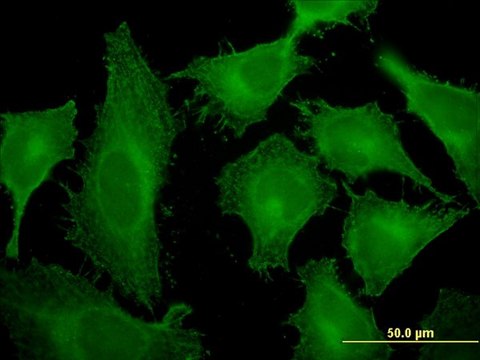 Monoclonal Anti-TMOD3, (C-terminal) antibody produced in mouse clone 1E1, purified immunoglobulin, buffered aqueous solution