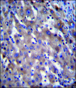 ANTI-RPGR (C-TERM) antibody produced in rabbit IgG fraction of antiserum, buffered aqueous solution