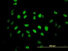 Monoclonal Anti-TLK2 antibody produced in mouse clone 2G7, purified immunoglobulin, buffered aqueous solution