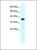 Anti-C4BPB antibody produced in rabbit affinity isolated antibody