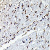 Anti- TTC11/FIS1 antibody produced in rabbit