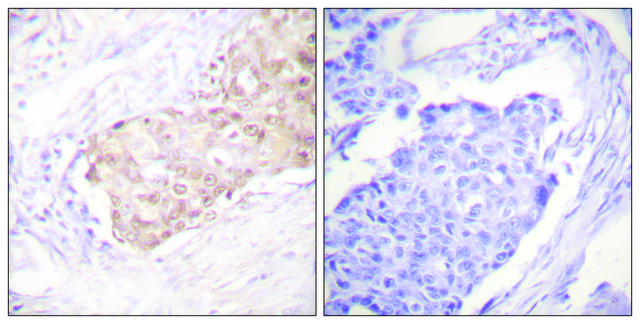 Anti-EDD antibody produced in rabbit affinity isolated antibody