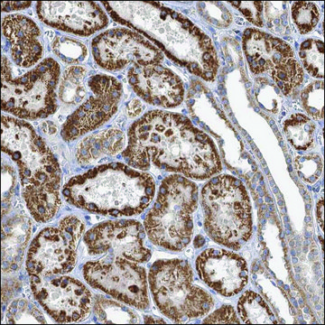 Anti-IL11RA antibody produced in rabbit Prestige Antibodies&#174; Powered by Atlas Antibodies, affinity isolated antibody, buffered aqueous glycerol solution