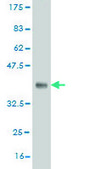 Monoclonal Anti-GSR antibody produced in mouse clone 6B4, purified immunoglobulin, buffered aqueous solution