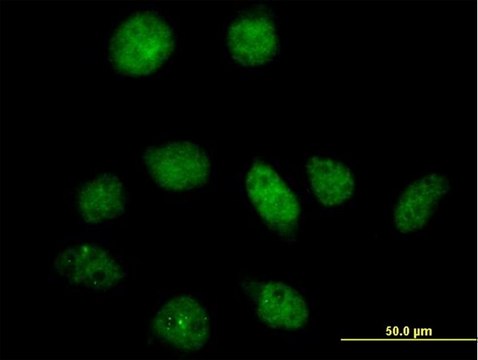 Anti-PFKFB3 antibody produced in mouse IgG fraction of antiserum, buffered aqueous solution