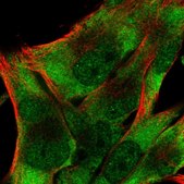 Anti-EIF3D antibody produced in rabbit Prestige Antibodies® Powered by Atlas Antibodies, affinity isolated antibody, buffered aqueous glycerol solution