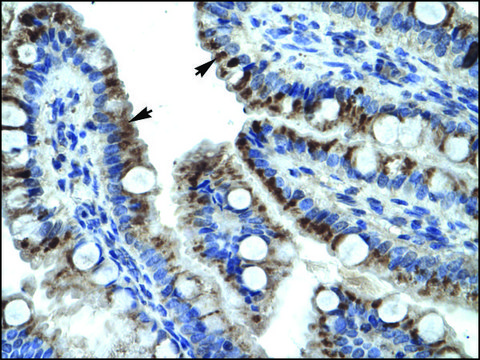 Anti-KRT15 antibody produced in rabbit affinity isolated antibody