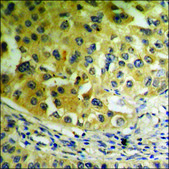 Anti-phospho-Akt (pThr72) antibody produced in rabbit affinity isolated antibody