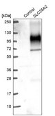 Anti-SLC26A2 antibody produced in rabbit Prestige Antibodies® Powered by Atlas Antibodies, affinity isolated antibody, buffered aqueous glycerol solution