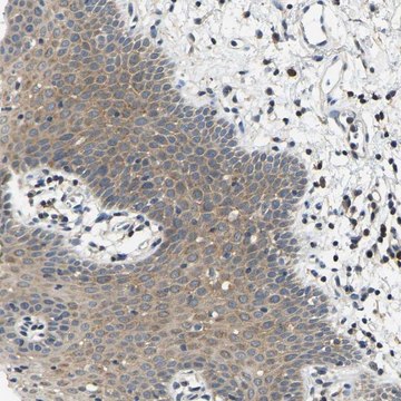 Anti-AHNAK antibody produced in rabbit Prestige Antibodies&#174; Powered by Atlas Antibodies, affinity isolated antibody, buffered aqueous glycerol solution