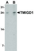 Anti-TMIGD1 antibody produced in rabbit affinity isolated antibody