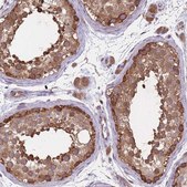 Anti-ARL13B antibody produced in rabbit Prestige Antibodies® Powered by Atlas Antibodies, affinity isolated antibody, buffered aqueous glycerol solution