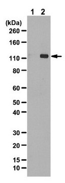 Anti-phospho-ULK1 (Ser555) Antibody from rabbit, purified by affinity chromatography