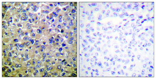 Anti-PP1-&#945; antibody produced in rabbit affinity isolated antibody