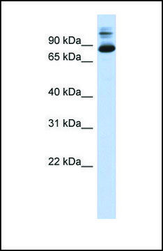 Anti-SIX4, (N-terminal) antibody produced in rabbit affinity isolated antibody