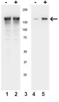 Anti-phospho-EGFR (Tyr1086) Antibody Upstate&#174;, from rabbit