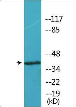 Anti-phospho-Opioid Receptor-&#948; (pSer363) antibody produced in rabbit affinity isolated antibody