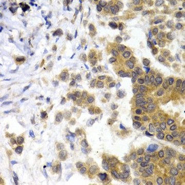 Anti-NEFL antibody produced in rabbit