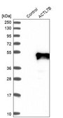 Anti-ACTL7B antibody produced in rabbit Prestige Antibodies® Powered by Atlas Antibodies, affinity isolated antibody, buffered aqueous glycerol solution, Ab2