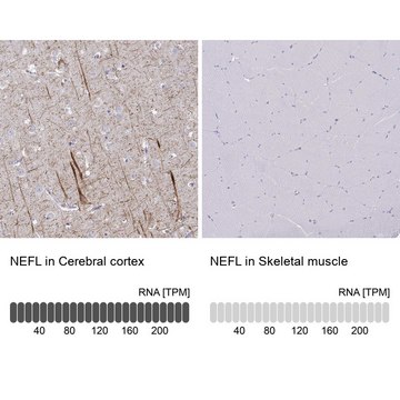 Anti-NEFL antibody produced in rabbit Prestige Antibodies&#174; Powered by Atlas Antibodies, affinity isolated antibody, buffered aqueous glycerol solution