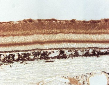 Anti-Sodium Channel NaB2 Antibody Chemicon&#174;, from rabbit