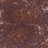 Anti-RNF19B antibody produced in rabbit Prestige Antibodies® Powered by Atlas Antibodies, affinity isolated antibody, buffered aqueous glycerol solution