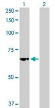 Anti-GBA antibody produced in rabbit purified immunoglobulin, buffered aqueous solution