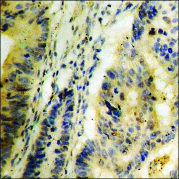 抗 磷酸化-Trk C (pTyr 516 ) 兔抗 affinity isolated antibody