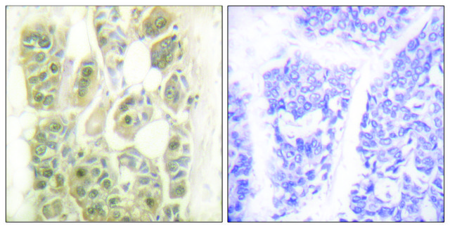 Anti-SSB antibody produced in rabbit affinity isolated antibody