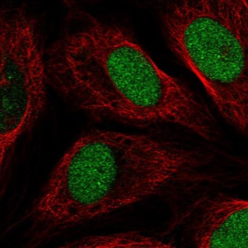 Anti-ETNPPL antibody produced in rabbit Prestige Antibodies&#174; Powered by Atlas Antibodies, affinity isolated antibody