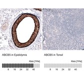 Monoclonal Anti-ABCB5 antibody produced in mouse Prestige Antibodies® Powered by Atlas Antibodies, clone CL13618, purified antibody (Protein A)