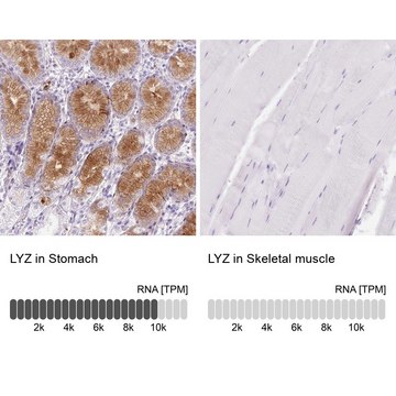 Anti-LYZ antibody produced in rabbit Prestige Antibodies&#174; Powered by Atlas Antibodies, affinity isolated antibody, buffered aqueous glycerol solution