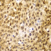 Anti-IRF3 antibody produced in rabbit