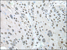 Anti-POT1 affinity isolated antibody