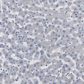 Anti-PPM1E antibody produced in rabbit Prestige Antibodies® Powered by Atlas Antibodies, affinity isolated antibody, buffered aqueous glycerol solution, Ab1