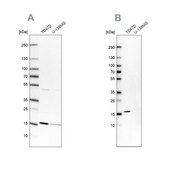 Anti-POLR2H antibody produced in rabbit Prestige Antibodies® Powered by Atlas Antibodies, affinity isolated antibody, buffered aqueous glycerol solution