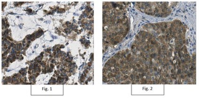 Anti-Thymidylate Kinase/TMPK Antibody, clone 1A5.1 clone 1A5.1, from mouse