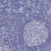Anti-DDAH1 antibody produced in rabbit Prestige Antibodies® Powered by Atlas Antibodies, affinity isolated antibody, buffered aqueous glycerol solution