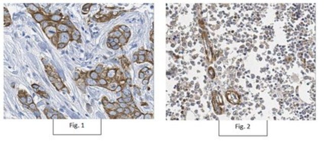 Anti-BCL2A1/BFL-1 Antibody from rabbit, purified by affinity chromatography