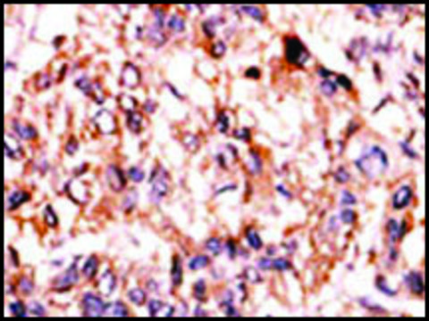 Anti-ADCK1 (N-term) antibody produced in rabbit IgG fraction of antiserum, buffered aqueous solution