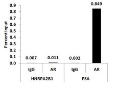 ChIPAb+ Androgen Receptor- ChIP Validated Antibody and Primer Set from rabbit, purified by affinity chromatography