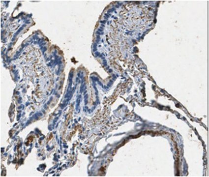 Anti-Surfactant Protein A Antibody from rabbit