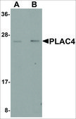 Anti-PLAC4 antibody produced in rabbit affinity isolated antibody, buffered aqueous solution