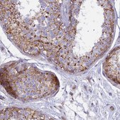 Anti-CLCN7 antibody produced in rabbit Prestige Antibodies® Powered by Atlas Antibodies, affinity isolated antibody, buffered aqueous glycerol solution