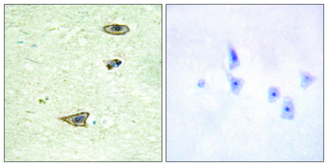 Anti-GRK1 antibody produced in rabbit affinity isolated antibody