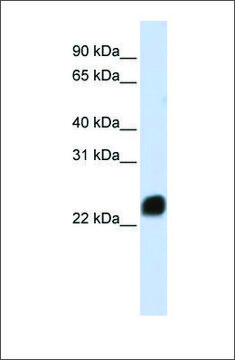 Anti-HMGB1 affinity isolated antibody